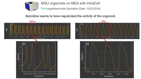 Graphs of organoids on IntraCell with multielectrode array system: Quinidine has regularized activity